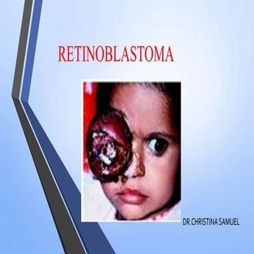 RETINOBLASTOMA