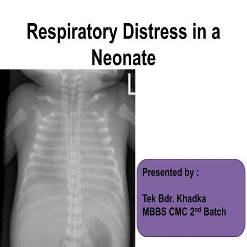 Neonatal Respiratory distress syndrome_.pdf