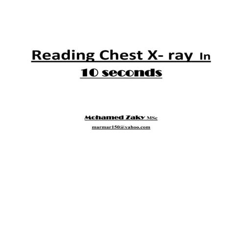Chest X ray in 10 seconds | PDF