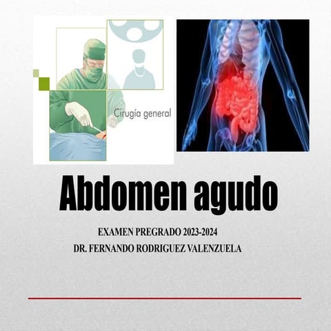 REAL Abdomen agudo casos clínicos y  tratamiento