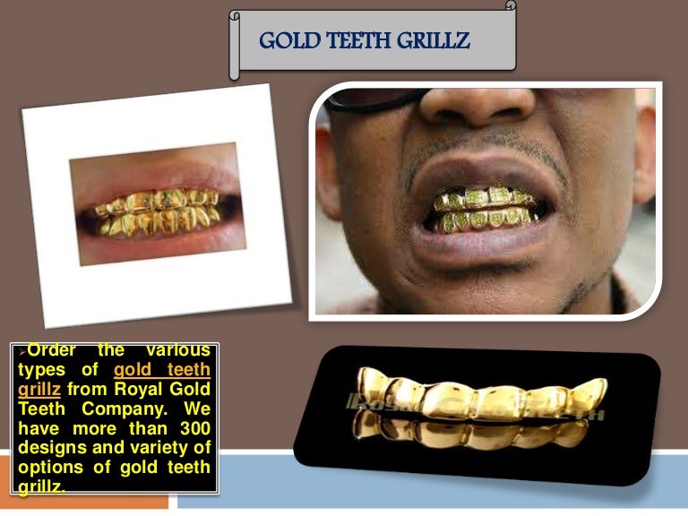 Real gold and silver teeth