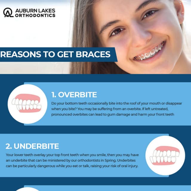 5 Reasons Why You Might Need Braces
