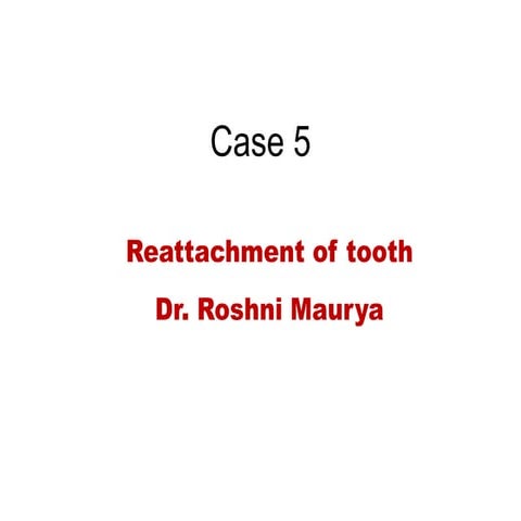 Reattachement of tooth