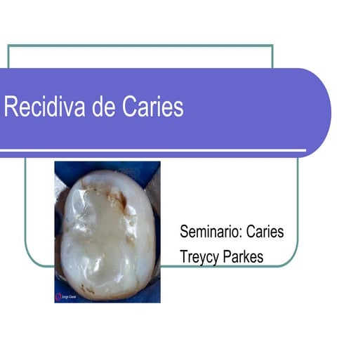 Recidiva de caries