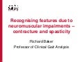 Recognising features (contracture and spasticity)