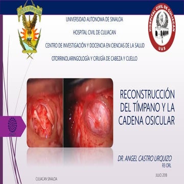 RECONSTRUCCIÓN DEL TÍMPANO Y LA CADENA OSICULAR