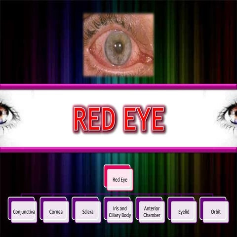 Red eye