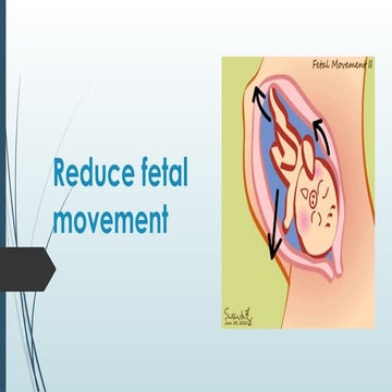 Reduced fetal movements | PPTX