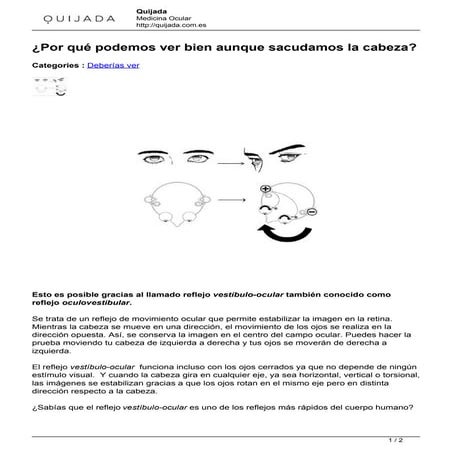 Reflejo oculovestibular