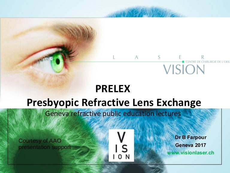 Refractive lens exchange 2017