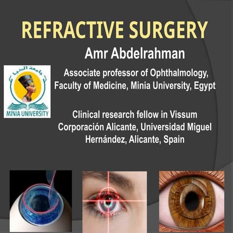 Refractive surgery for undergraduate simply