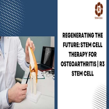 Regenerating the Future: Stem Cell Therapy for Osteoarthritis | R3 Stem ...
