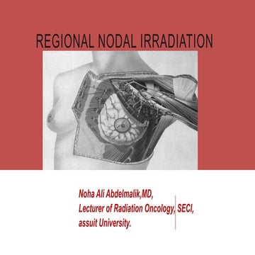 Regional nodal irradiation of breast cancer.pptx