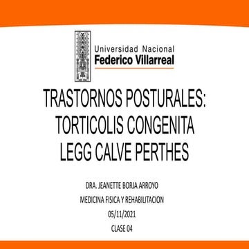 REHABILITACION EN TORTICOLIS CONGENITA Y ELCP UNFV 2021.pptx