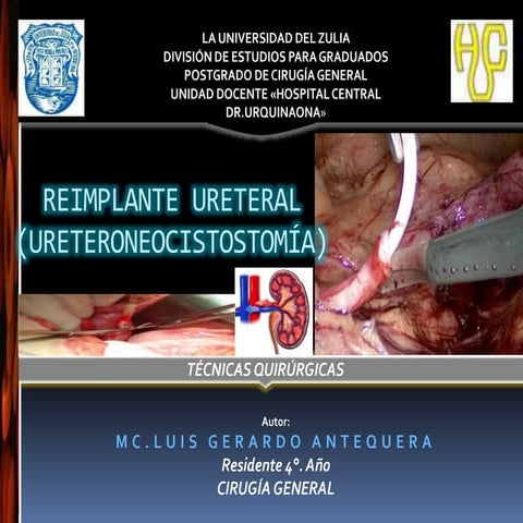 Reimplante ureteral 