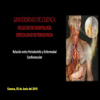 Relación entre periodontitis y enfe...