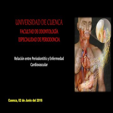 Relación entre periodontitis y enfermedad cardiovascular