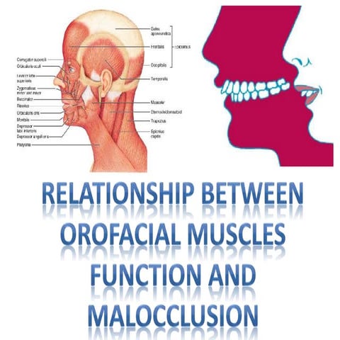Relationship between orofacial muscles function and malocclusion