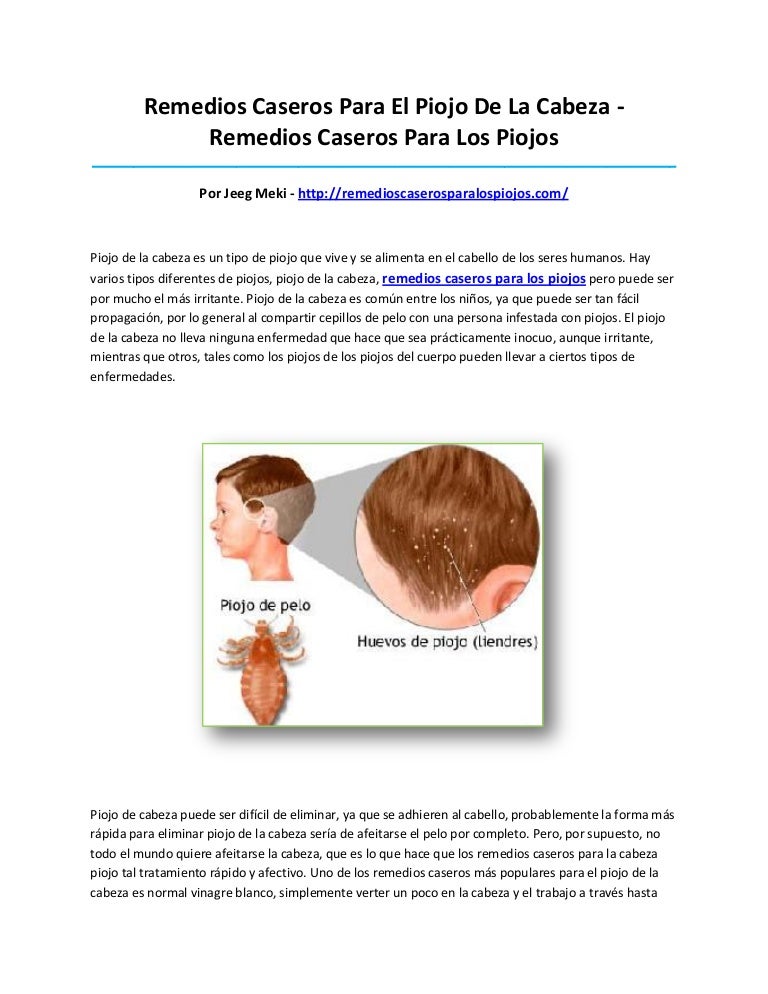 remedios naturales para eliminar los piojos de la cabeza