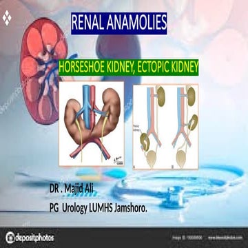 RENAL ANAMOLY PPT 2025 NEW RECENT ADVANCE | PPTX