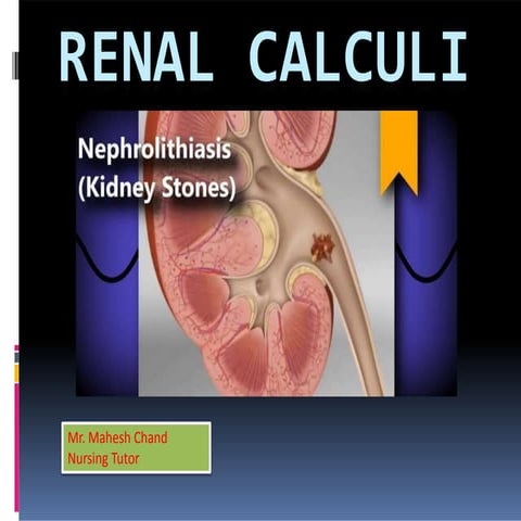 Renal calculi