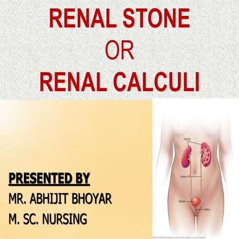 Renal calculi