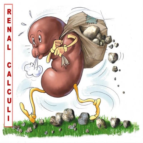 RENAL CALCULI.pptx hatvdhdbdhdbsbdvdhdff