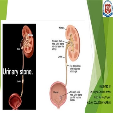 RENAL CALCULI 12UUUUUUUUUUUUUUUUUUU.pptx