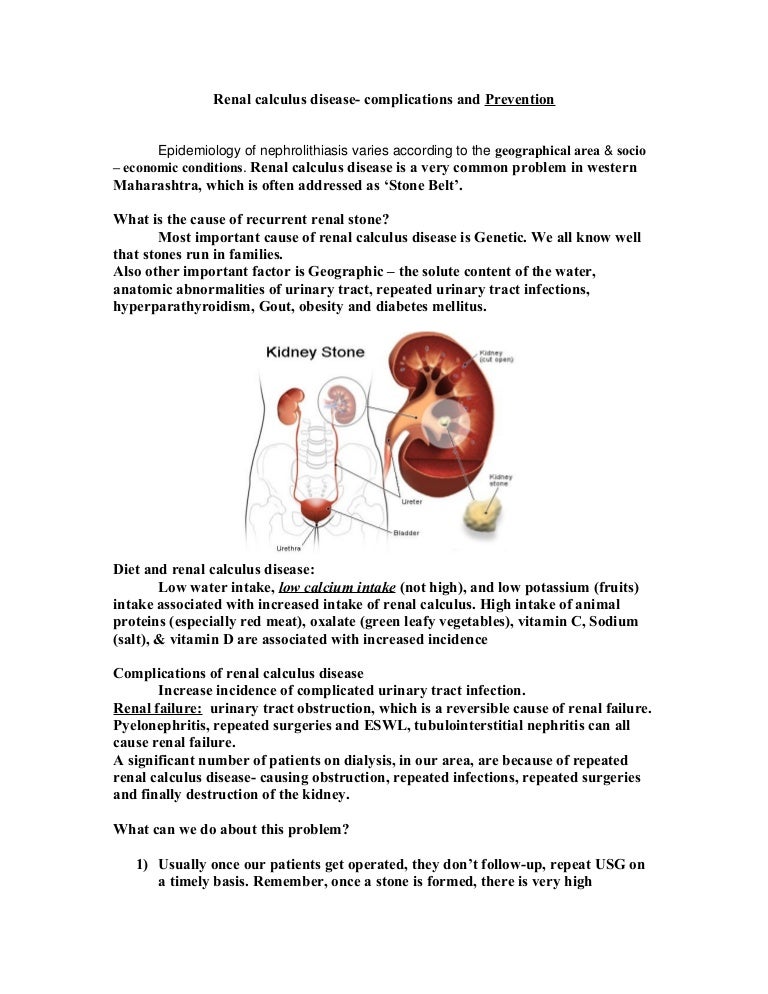 Renal calculus disease