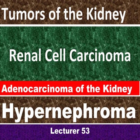 Renal cell carcinoma for students