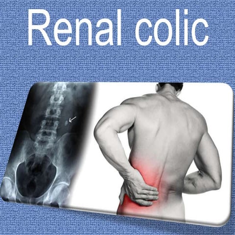Renal colic