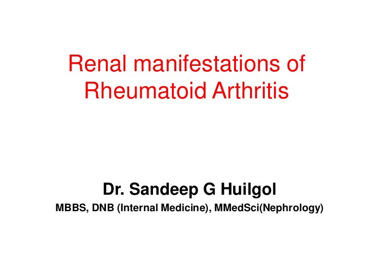 Renal manifestations of rheumatoid arthritis