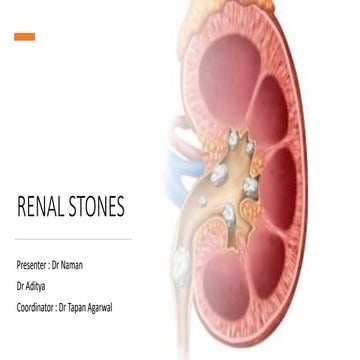 Renal stone.pptx