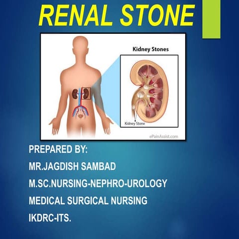 Renal stone 
