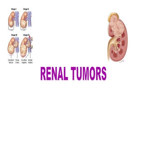 Renal tumors