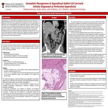 Tumors of appendix | PPTX