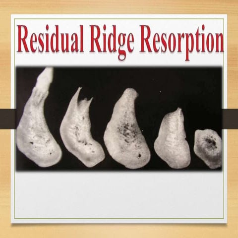Residual ridge resorption