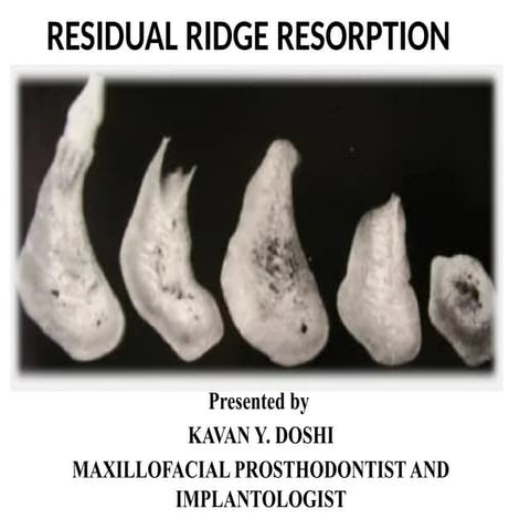Bone Resorption Pattern.pptx