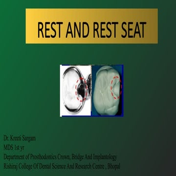 REST AND REST SEAT in dentistry in rpd.pptx