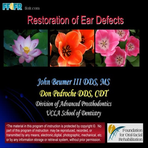 Restoration of ear defects