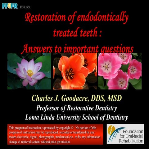 Restoration of endodontically treated teeth