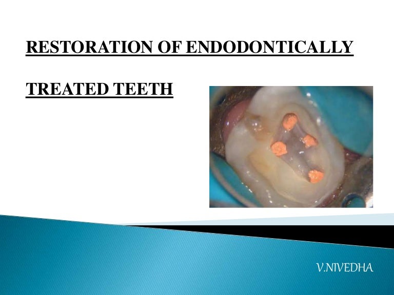 Restoration of endodontically treated teeth