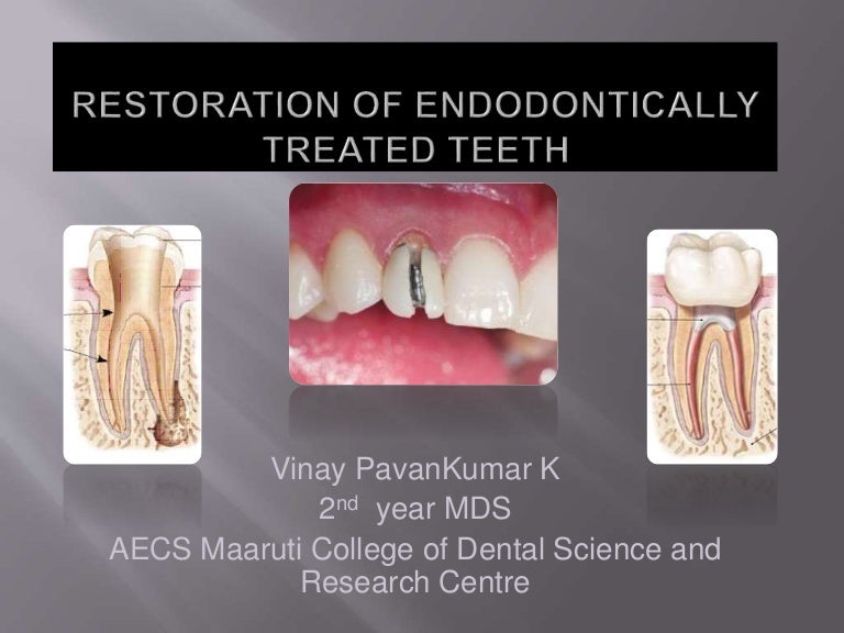 Prosthetic restoration of endodontically treated tooth