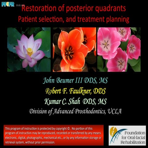 Restoration of posterior quadrants