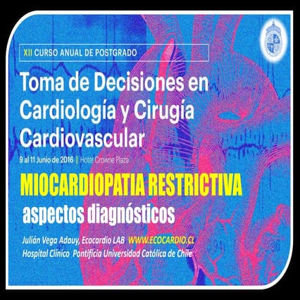 Miocardiopatia restrictiva: aspectos diagnósticos