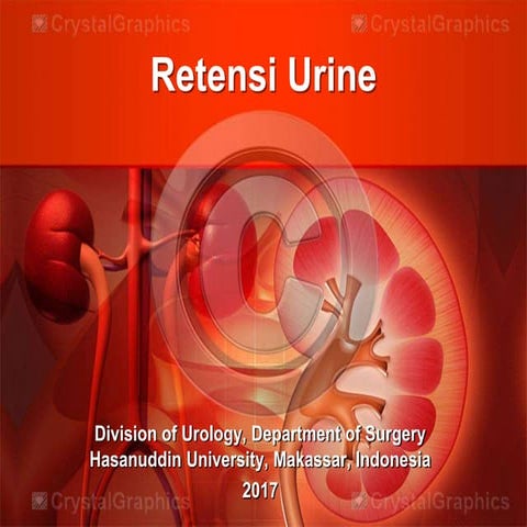 Retensi urine