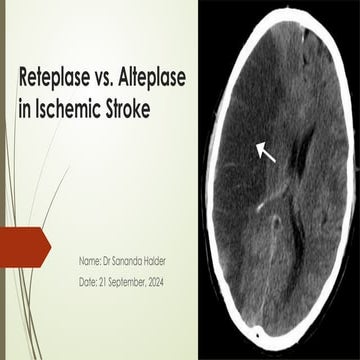 Reteplase Vs Alteplase in Ischaemic stroke.pptx