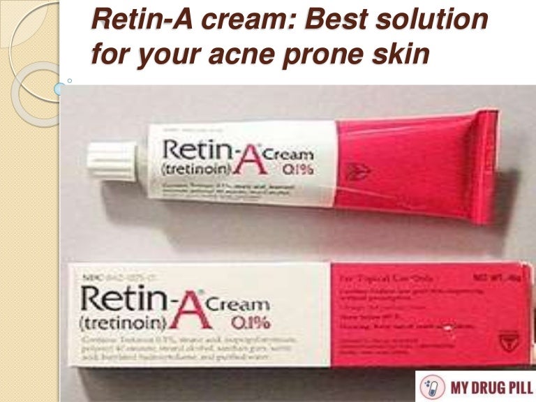 Retin-A cream: Best solution for your acne prone skin Retin-A cream: Best solution for your acne prone skin