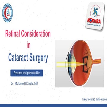 Retinal consideration in cataract surgery