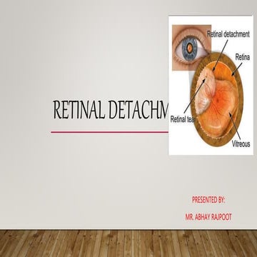 Retinal Detachment